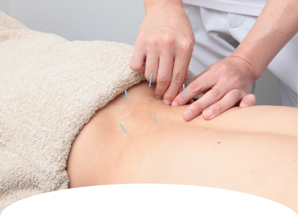 WHOが認める鍼灸治療